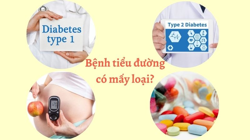 Ph&acirc;n loại đ&aacute;i th&aacute;o đường