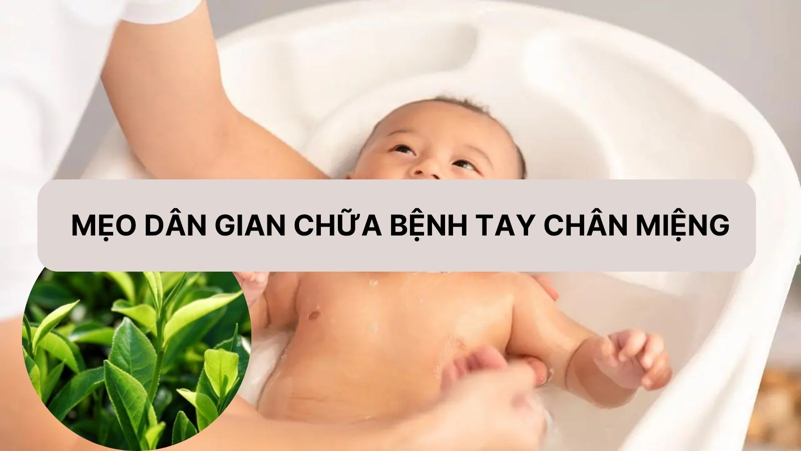 16 mẹo dân gian chữa tay chân miệng: Có nên áp dụng không?