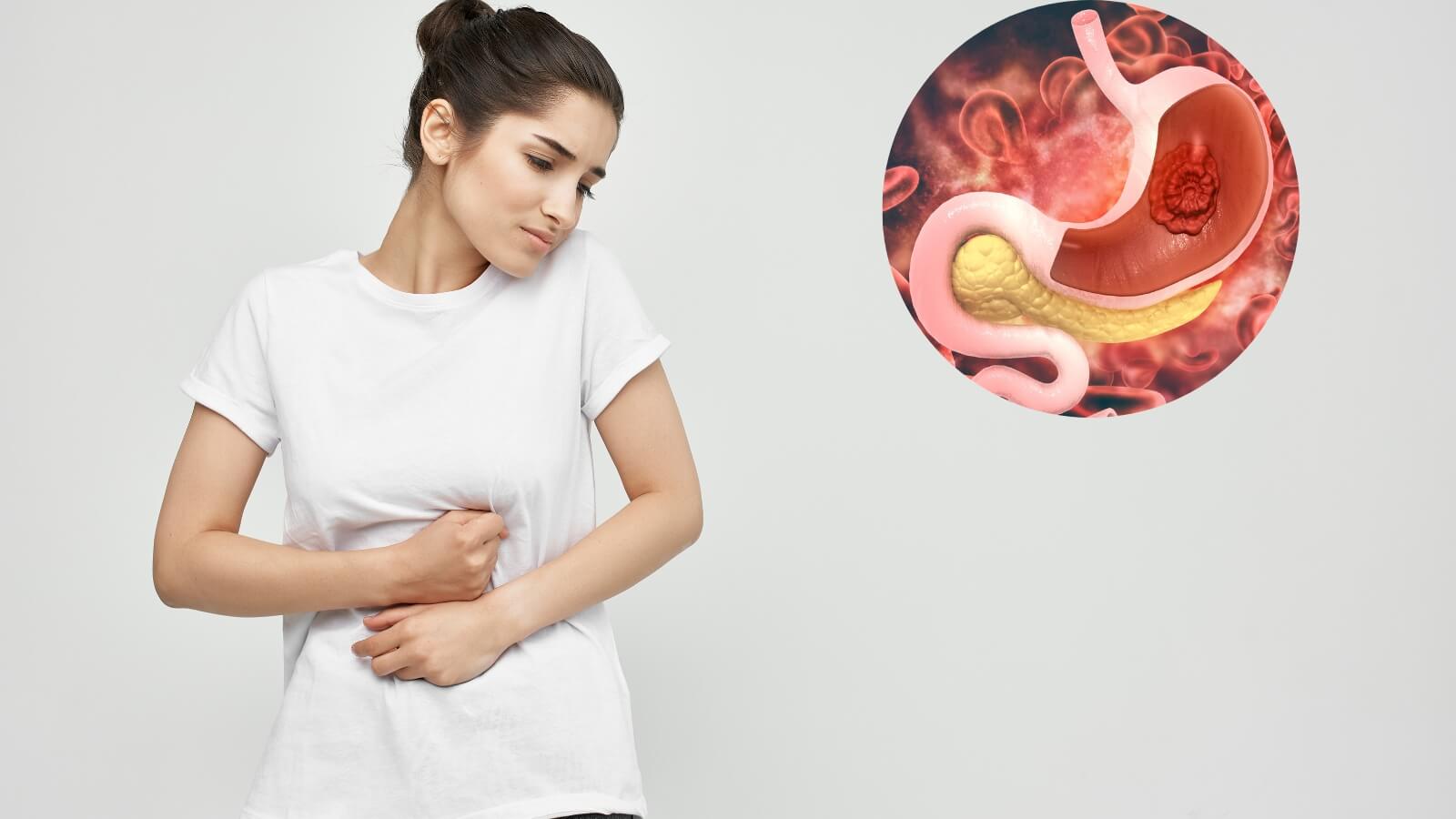 Đau v&ugrave;ng thượng vị l&agrave; triệu chứng đau dạ d&agrave;y phổ biến nhất