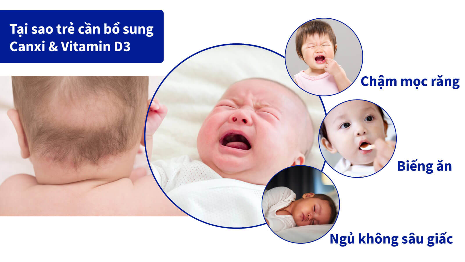 Canxi v&agrave; Vitamin D3 c&oacute; vai tr&ograve; quan trọng cho sự ph&aacute;t triển của trẻ