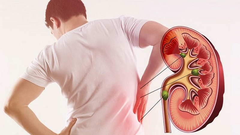 Biến chứng thận ở bệnh nh&acirc;n tiểu đường