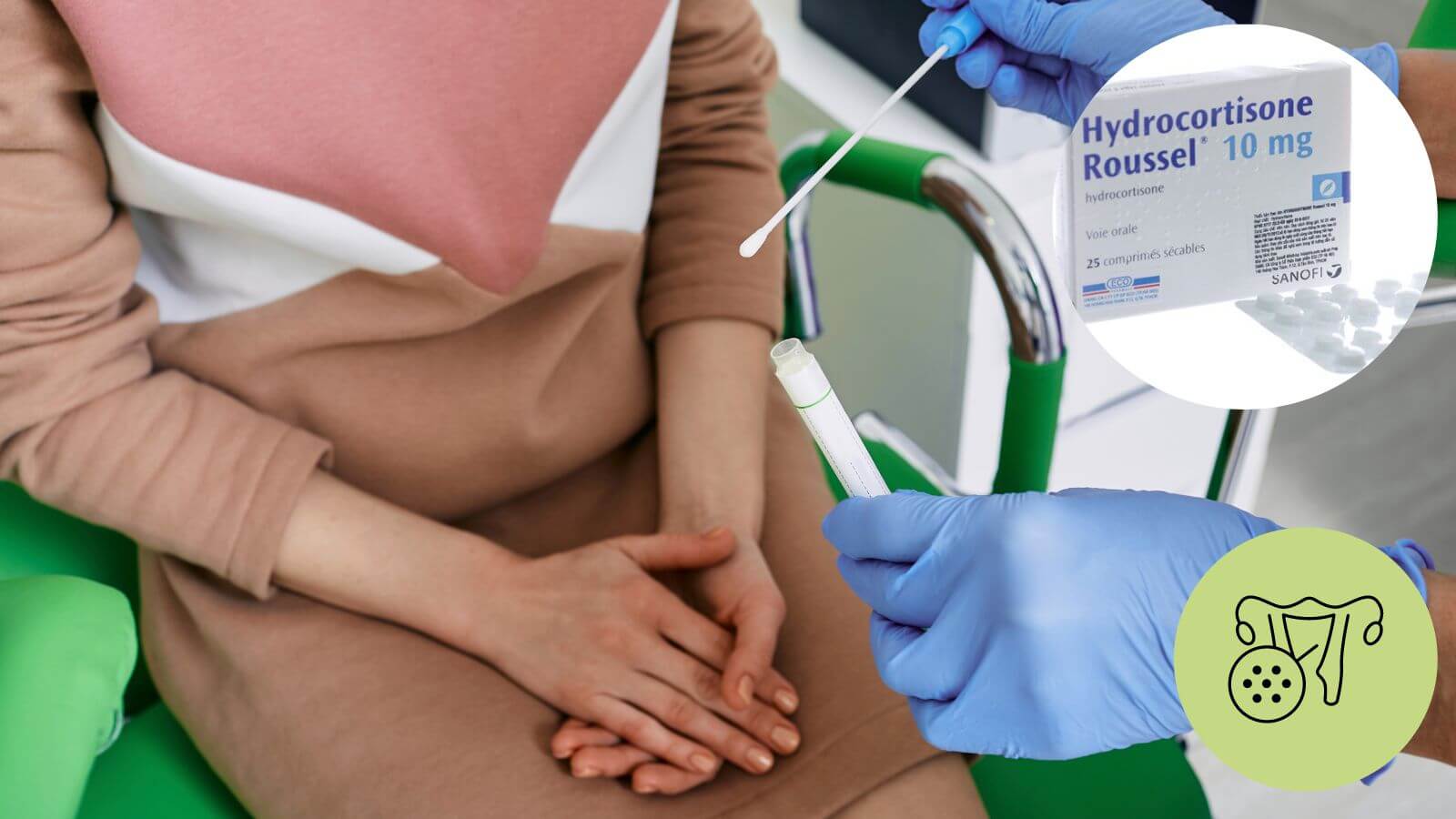 Lạm dụng thuốc chống vi&ecirc;m l&agrave;m tăng nguy cơ vi&ecirc;m nhiễm phụ khoa