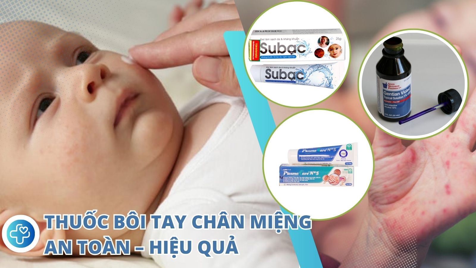 Tìm hiểu những loại thuốc bôi hiệu quả giúp bé nhanh khỏi