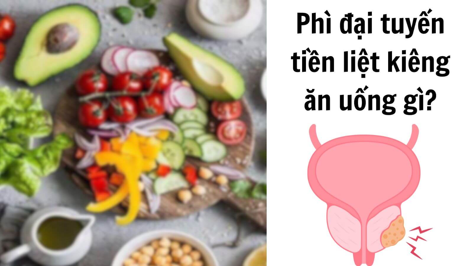 [Giải đáp] Nam giới bị phì đại tuyến tiền liệt kiêng ăn uống gì?