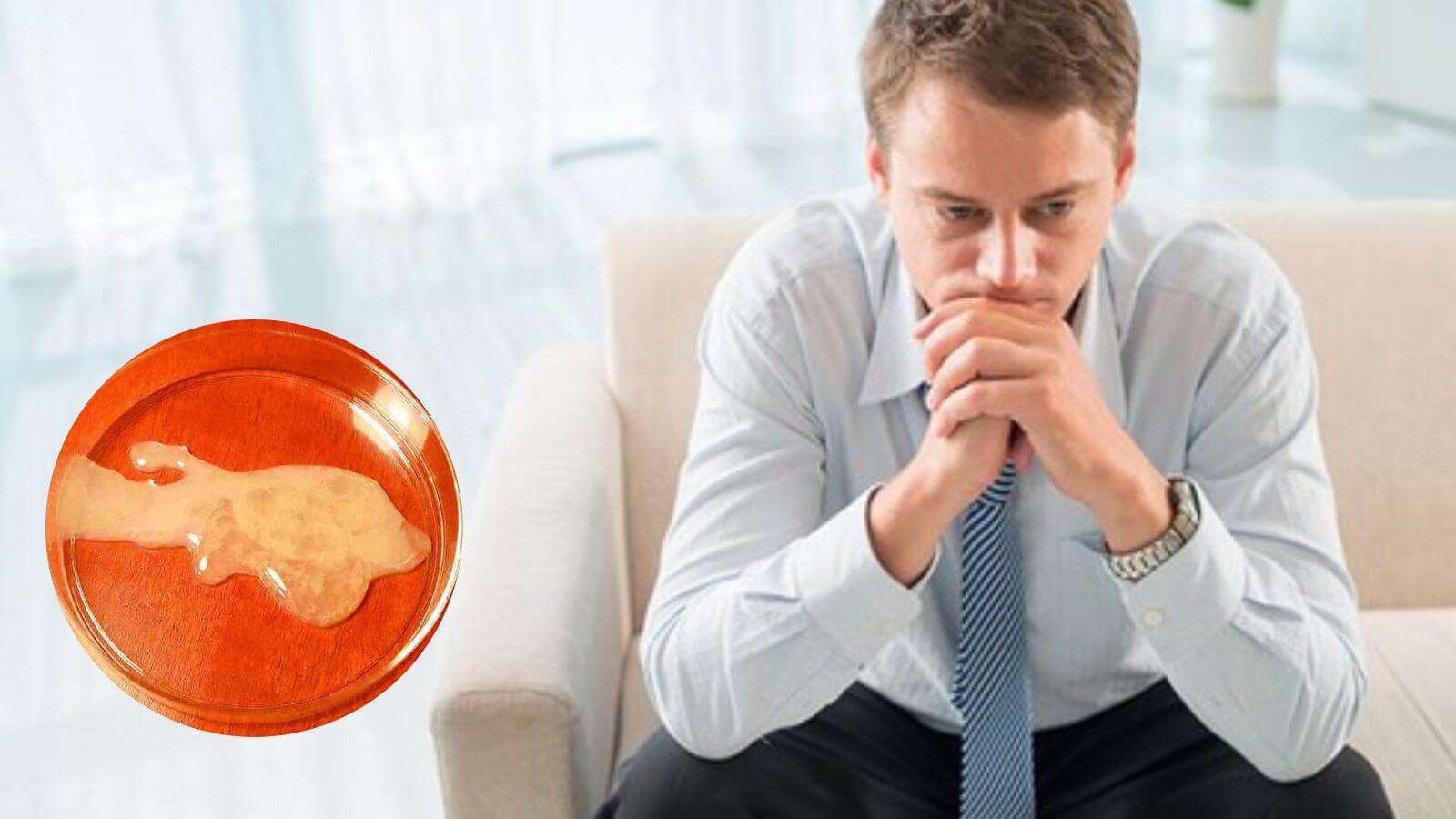 Tình trùng vón cục như thạch có sao không? Câu trả lời là có