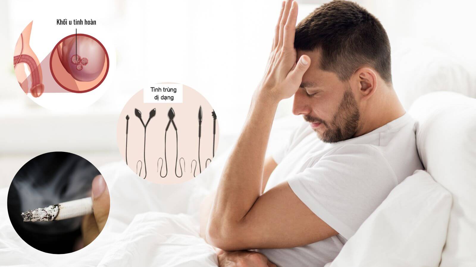 C&oacute; nhiều nguy&ecirc;n nh&acirc;n khiến nam giới v&ocirc; sinh