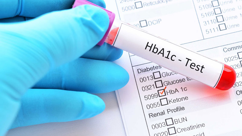 Lấy m&aacute;u x&eacute;t nghiệm HbA1c