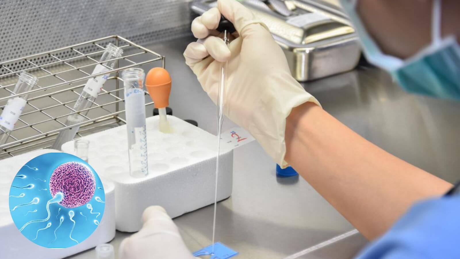 X&eacute;t nghiệm tinh dịch đồ l&agrave; một x&eacute;t nghiệm rất quan trọng để cung cấp c&aacute;c th&ocirc;ng tin về chất lượng cũng như số lượng tinh tr&ugrave;ng