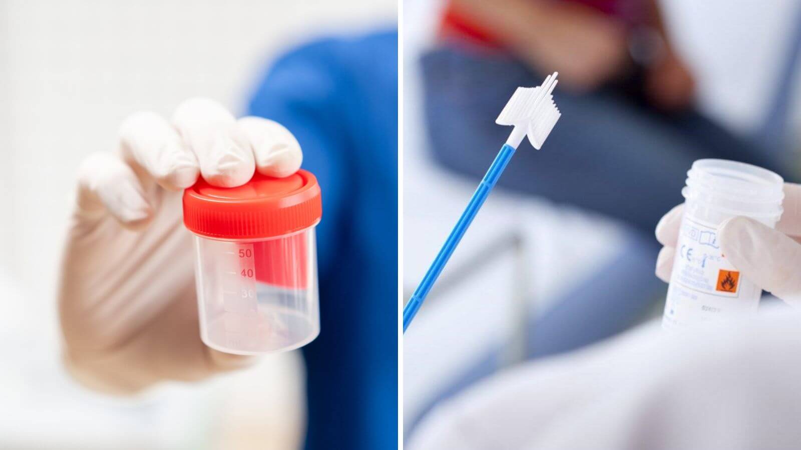 Hướng dẫn đọc kết quả tinh dịch đồ qua c&aacute;c chỉ số