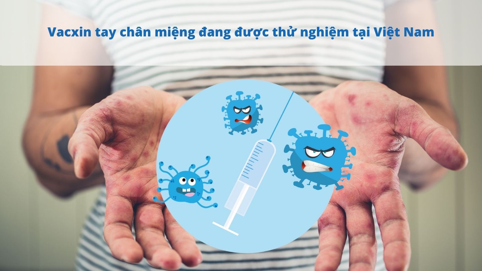 Vacxin ngừa tay ch&acirc;n miệng đang được thử nghiệm ở Việt Nam