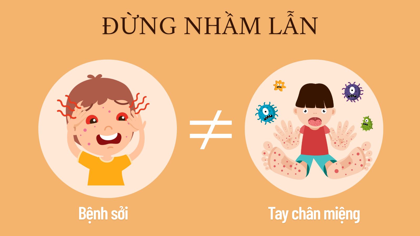 Đừng nhầm lẫn, sởi v&agrave; tay ch&acirc;n miệng l&agrave; hai bệnh kh&aacute;c nhau ho&agrave;n to&agrave;n