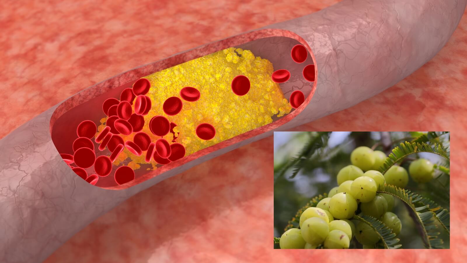 Me rừng c&ograve;n c&oacute; t&aacute;c dụng giảm cholesterone, ph&ograve;ng ngừa xơ vữa động mạch