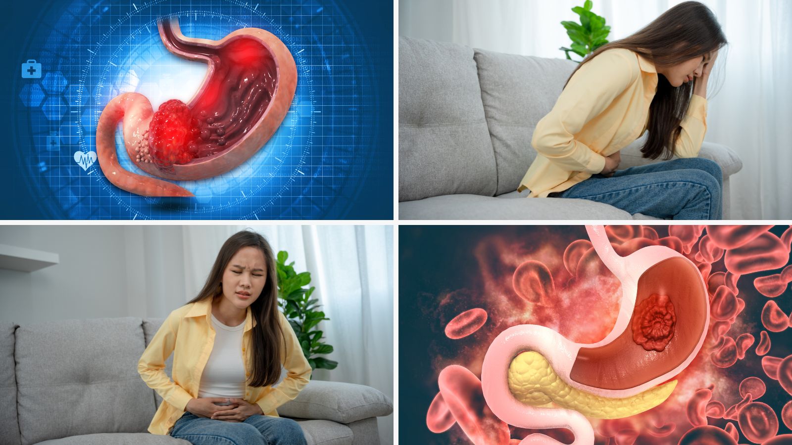 Bổ sung canxi kh&ocirc;ng đ&uacute;ng thời điểm dễ g&acirc;y đau dạ d&agrave;y
