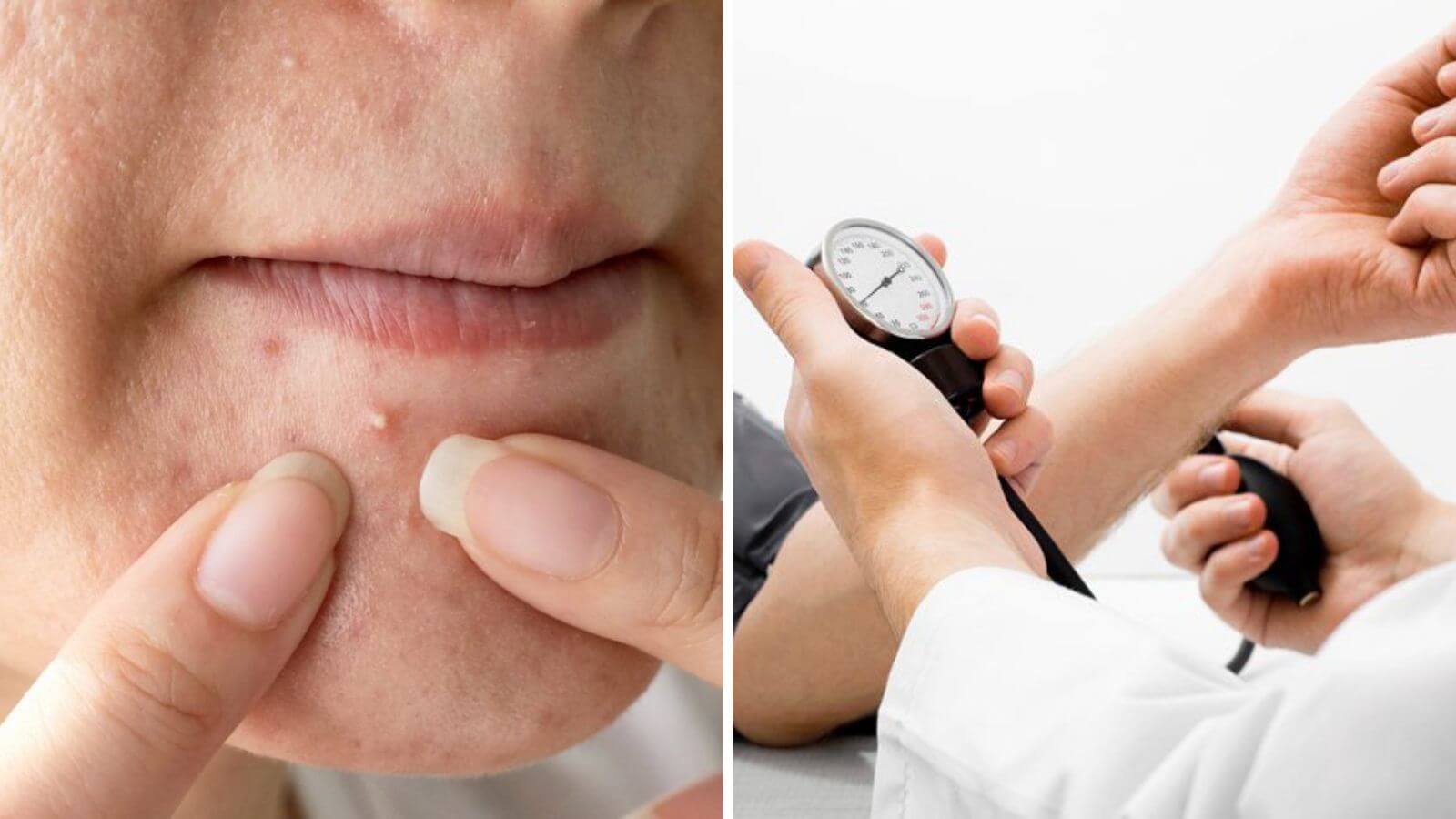 C&aacute;c dấu hiệu testosterone cao thường gặp ở nam giới