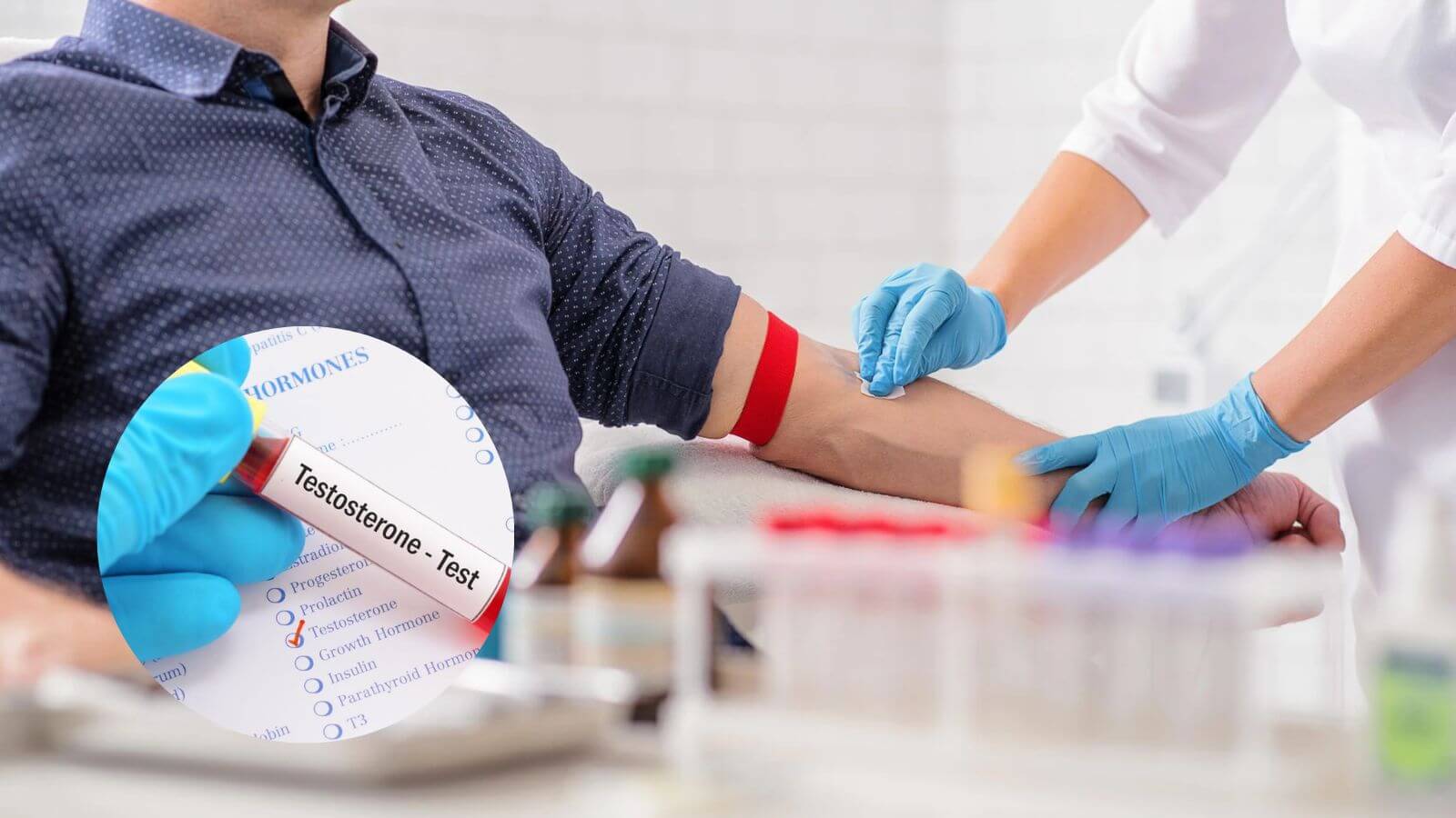 X&eacute;t nghiệm m&aacute;u để biết r&otilde; nồng độ testosterone trong cơ thể
