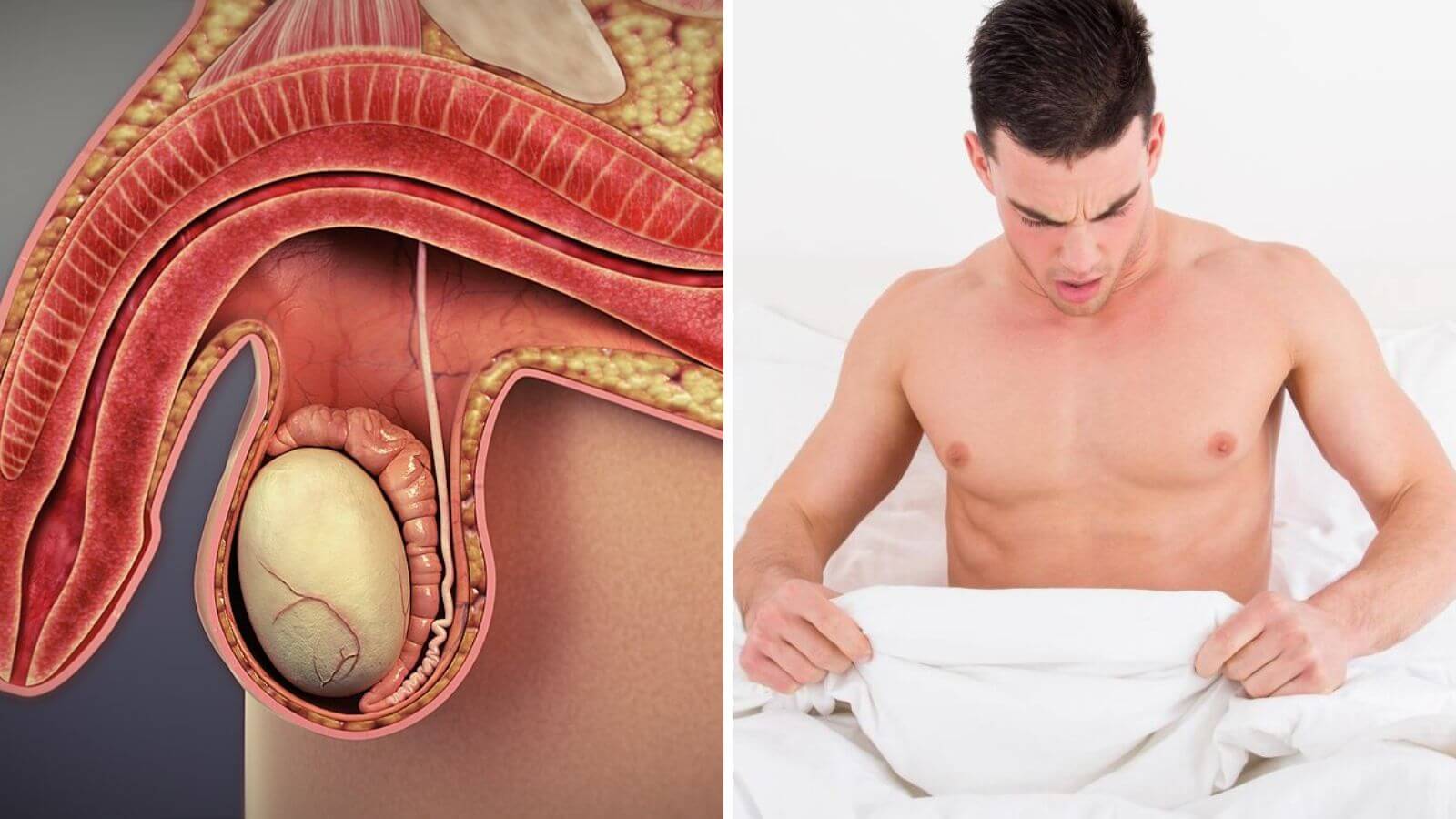 Rối loạn cương dương l&agrave; bệnh l&yacute; m&agrave; dương vật của nam giới kh&oacute; hoặc kh&ocirc;ng thể duy tr&igrave; ở trạng th&aacute;i cương cứng trong khi quan hệ