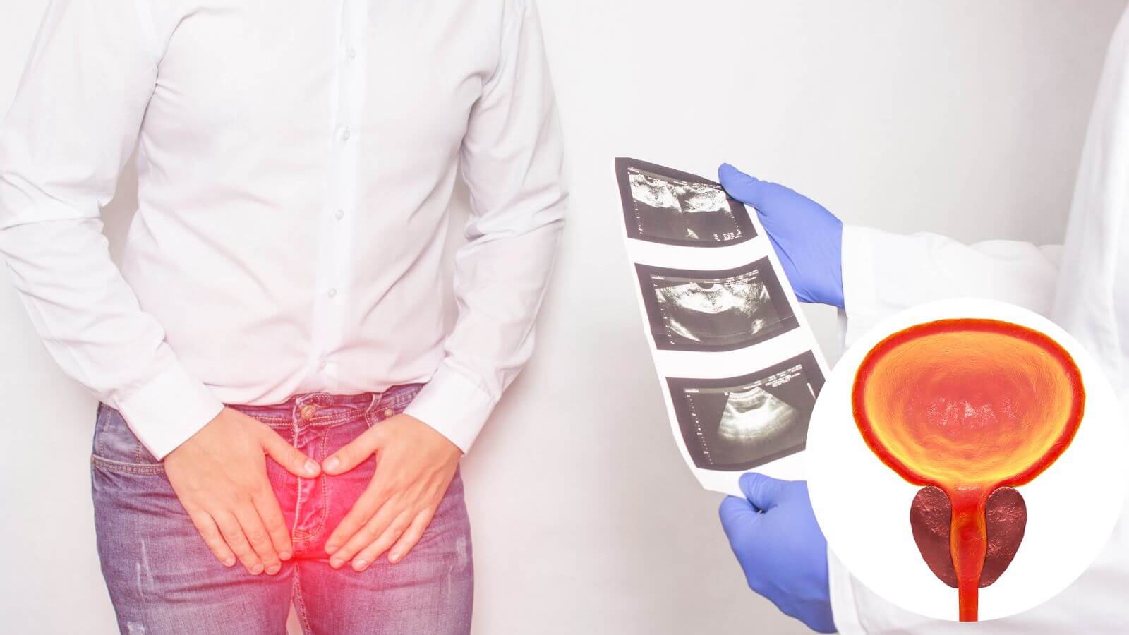Nam giới c&oacute; thể d&ugrave;ng c&aacute;c c&acirc;y thuốc nam chữa vi&ecirc;m tuyến tiền liệt