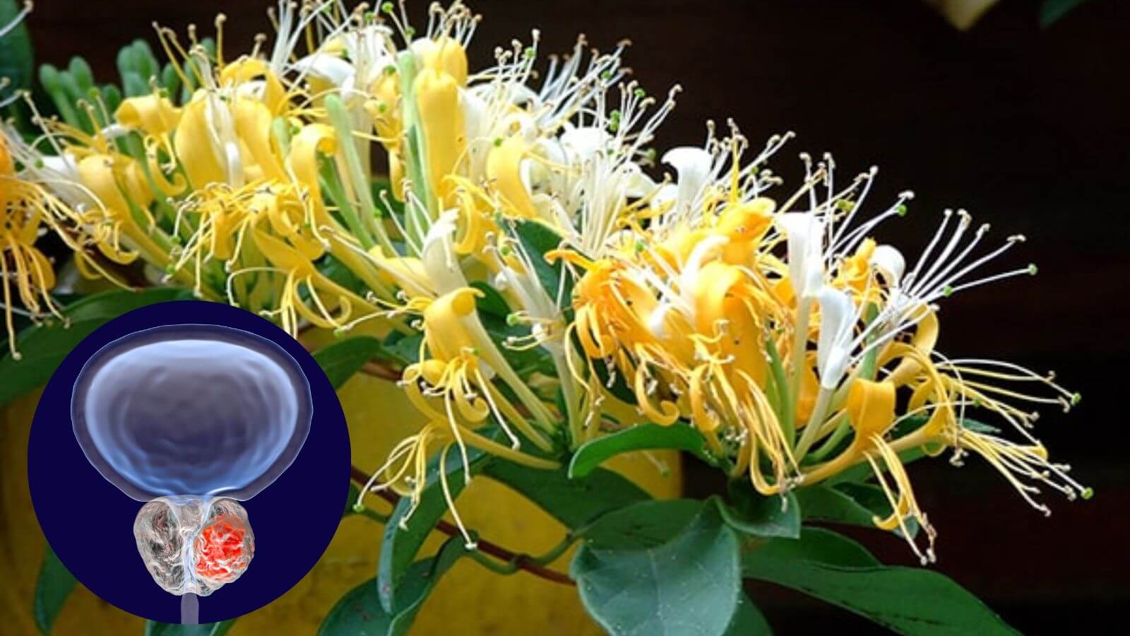 Thận trọng khi d&ugrave;ng kim ng&acirc;n với người thể h&agrave;n