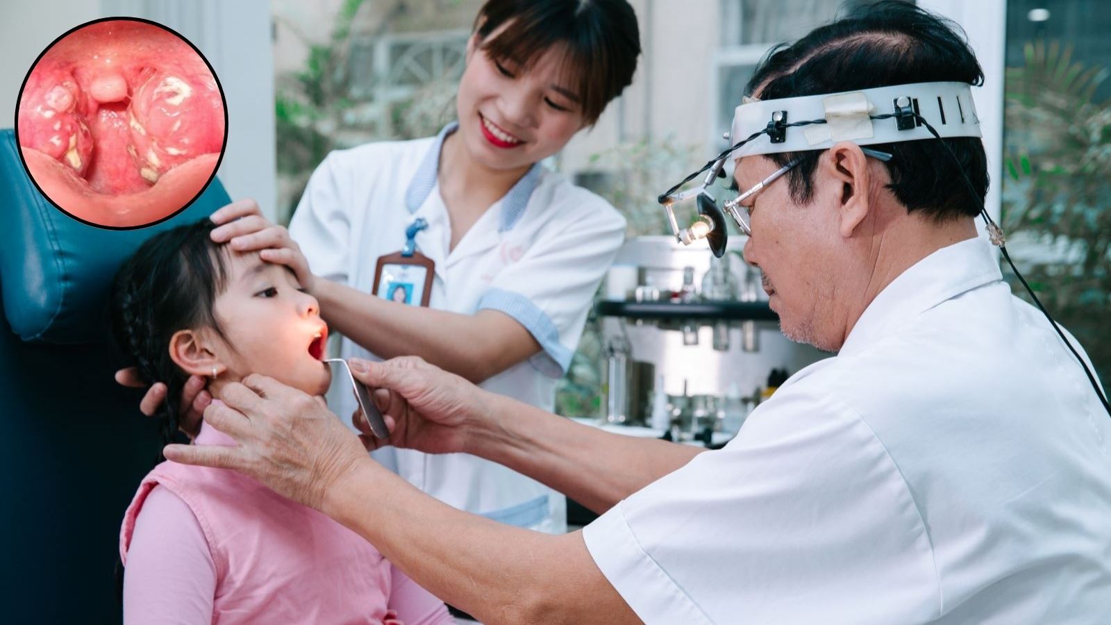 B&aacute;c sĩ kiểm tra họng để chẩn đo&aacute;n vi&ecirc;m họng hạt