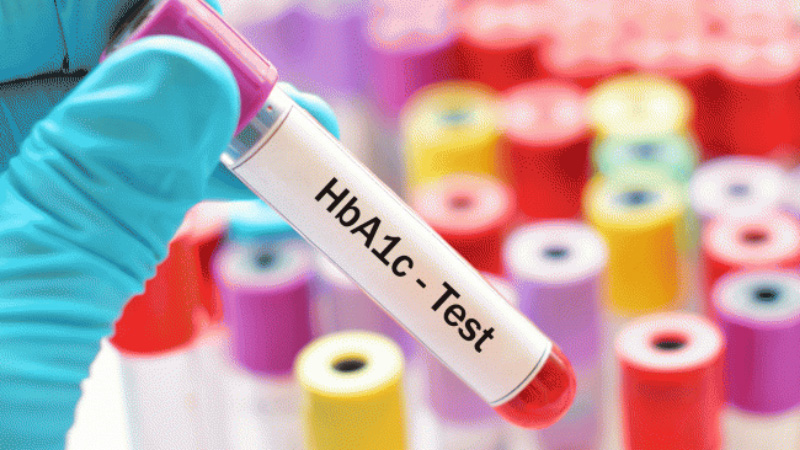 Chỉ số HbA1c là chỉ số quan trọng mang tính đánh giá và chẩn đoán bệnh tiểu đường.