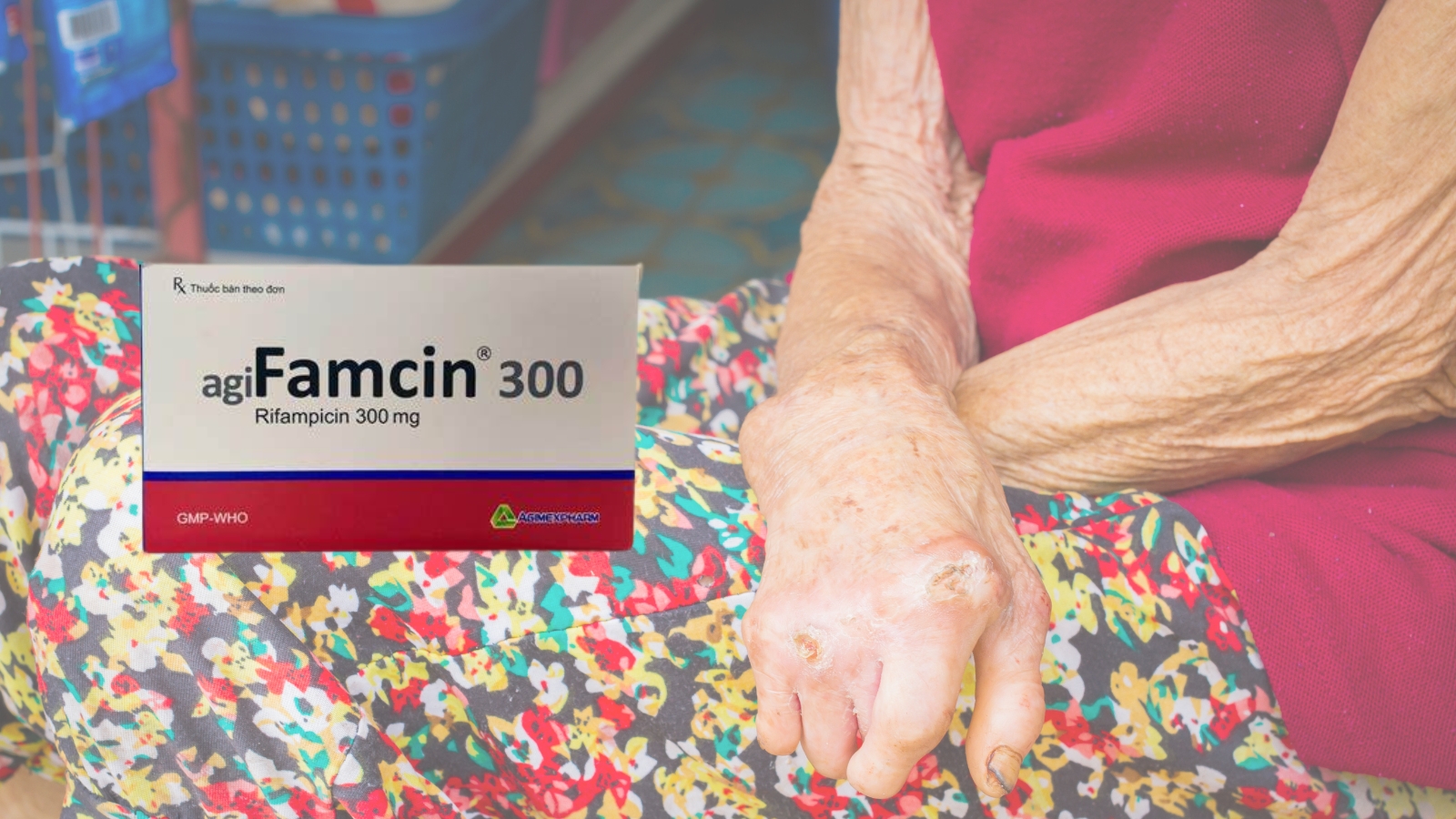 Agifamcin 300 chuy&ecirc;n d&ugrave;ng phối hợp Bắn Cá HZ88 là trò chơi giải trí điện tử bệnh phong