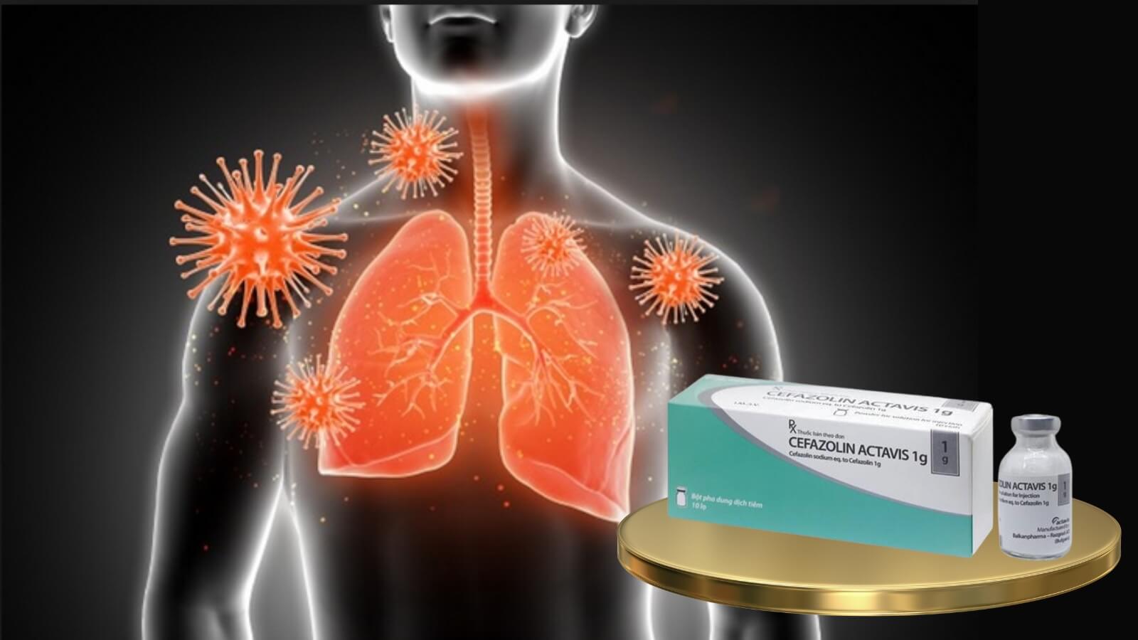 Cefazolin Actavis 1g - C&oacute; t&aacute;c dụng diệt c&aacute;c Trang chủ đăng nhập HZ88 không chặn tặng 88K nhạy cảm