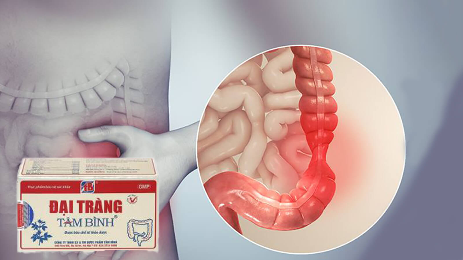 Đại tr&agrave;ng T&acirc;m B&igrave;nh - Hỗ trợ vi&ecirc;m đại tr&agrave;ng