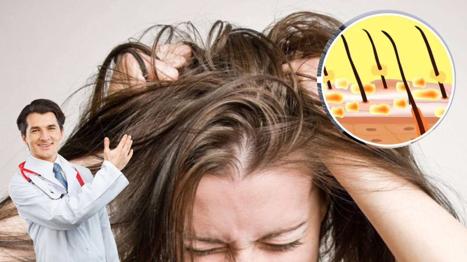 Dầu gội trị g&agrave;u g&oacute;i của Jasunny c&oacute; t&aacute;c dụng ngăn chặn nguy&ecirc;n nh&acirc;n tận gốc.