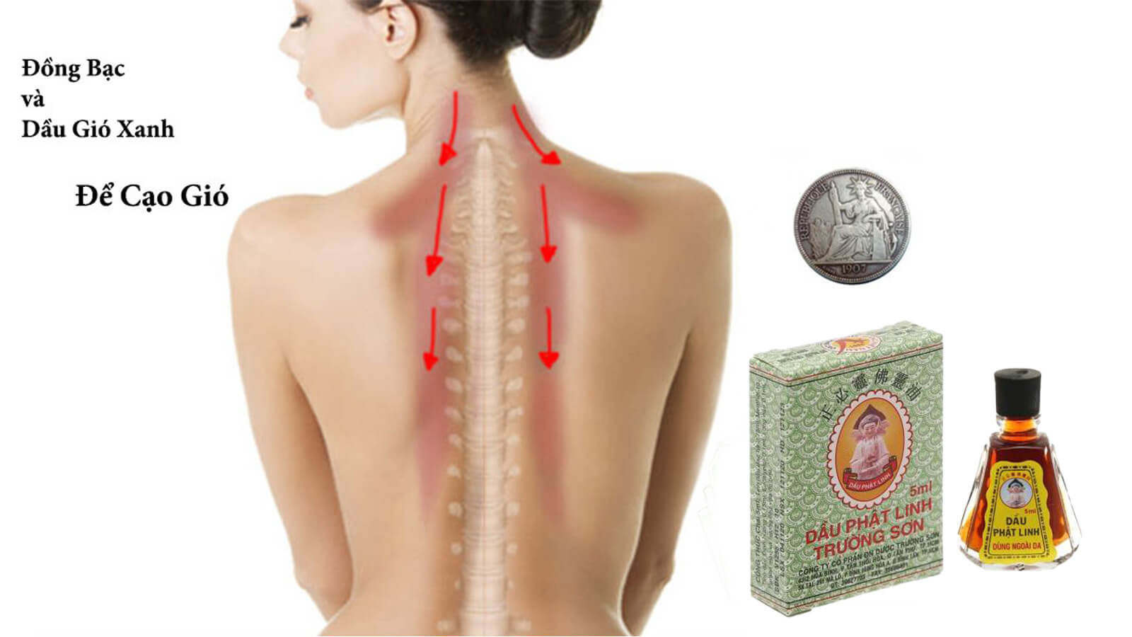 Cạo gi&oacute;, đ&aacute;nh cảm l&agrave; một h&igrave;nh thức chữa bệnh, thường l&agrave; chữa cảm được d&ugrave;ng phổ biến trong d&acirc;n gian