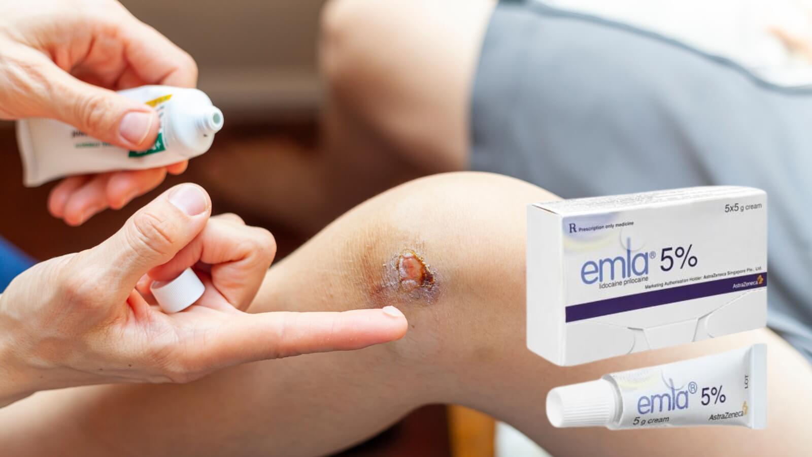 Thuốc Emla 5% gi&uacute;p g&acirc;y t&ecirc; tại chỗ hiệu quả