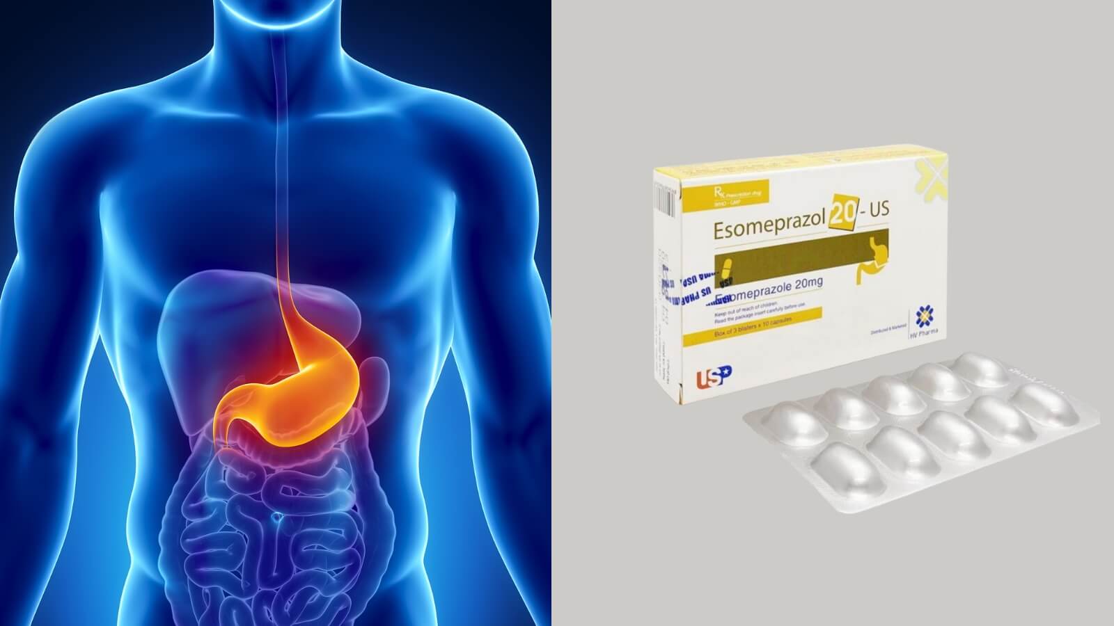 Esomeprazole 20mg chứa hoạt chất Esomeprazole, c&oacute; c&ocirc;ng dụng hiệu quả trong Bắn Cá HZ88 là trò chơi giải trí điện tử v&agrave; dự ph&ograve;ng lo&eacute;t dạ d&agrave;y