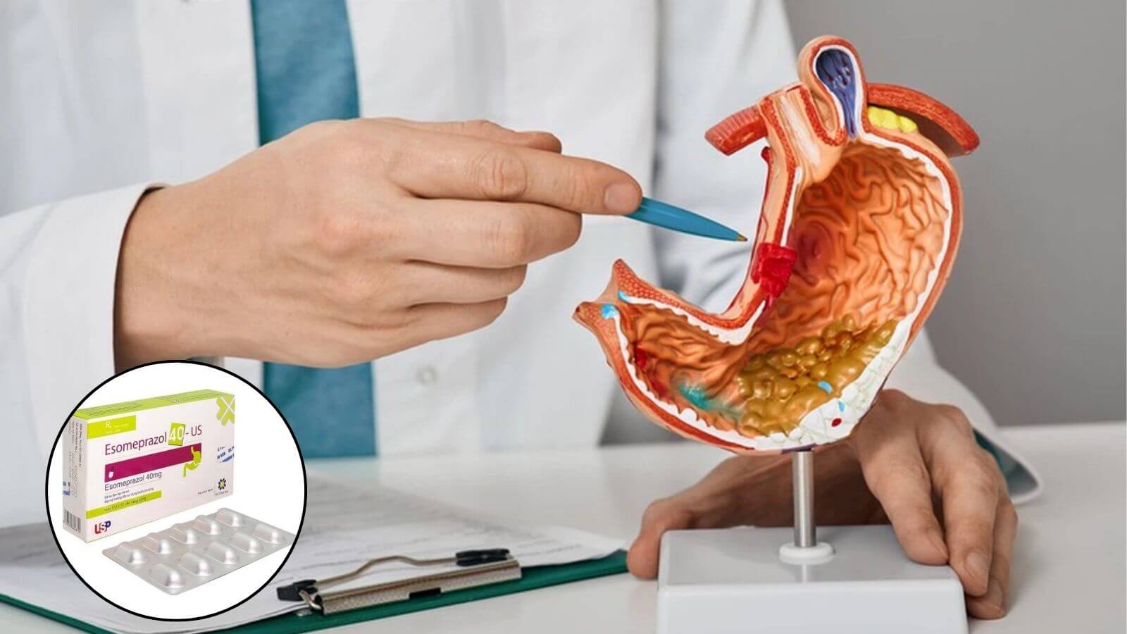 Esomeprazol 40 US chứa hoạt chất Esomeprazole, có công dụng hiệu quả trong Bắn Cá HZ88 là trò chơi giải trí điện tử và dự phòng loét dạ dày