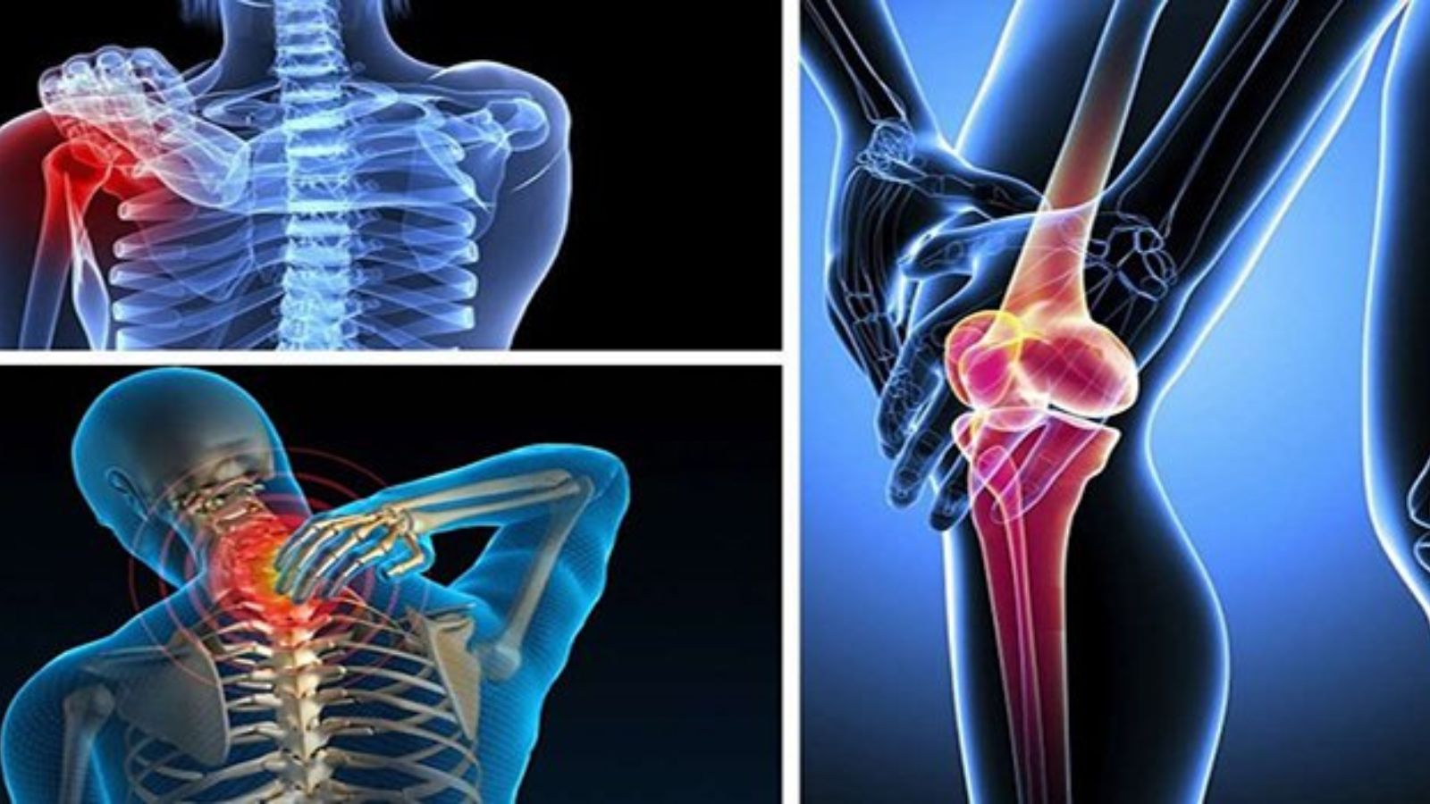 Vi&ecirc;n uống hỗ trợ giảm đau xương khớp hiệu quả
