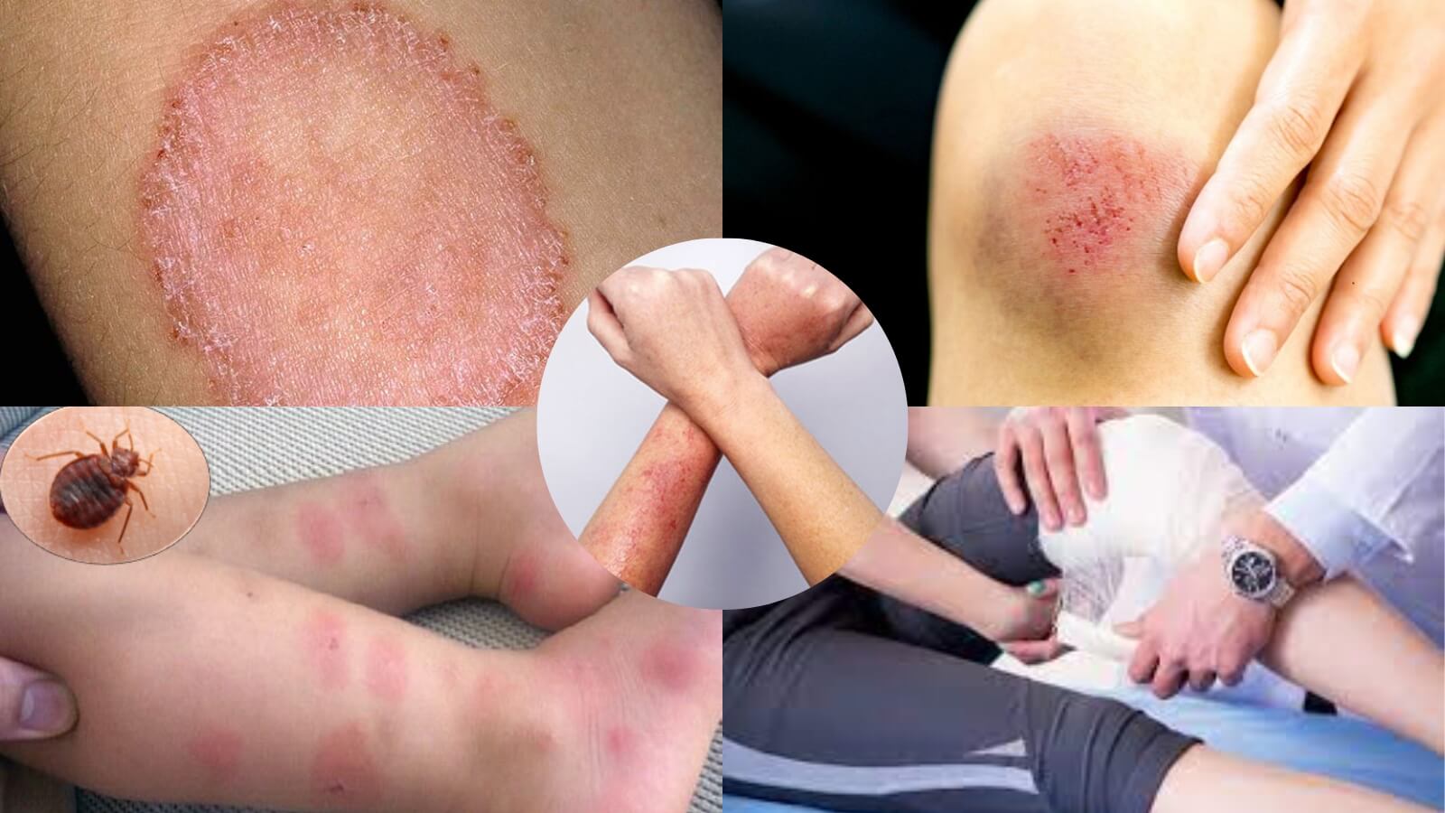 Tổn thương da c&oacute; thể do nhiều nguy&ecirc;n nh&acirc;n