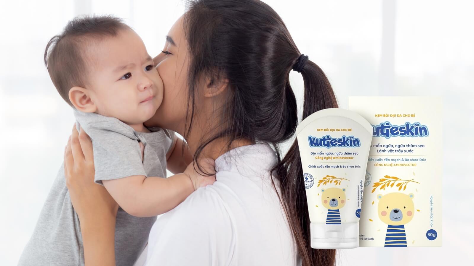 Kem b&ocirc;i dịu da Kutieskin - Giải ph&aacute;p hiệu quả cho l&agrave;n da của b&eacute;