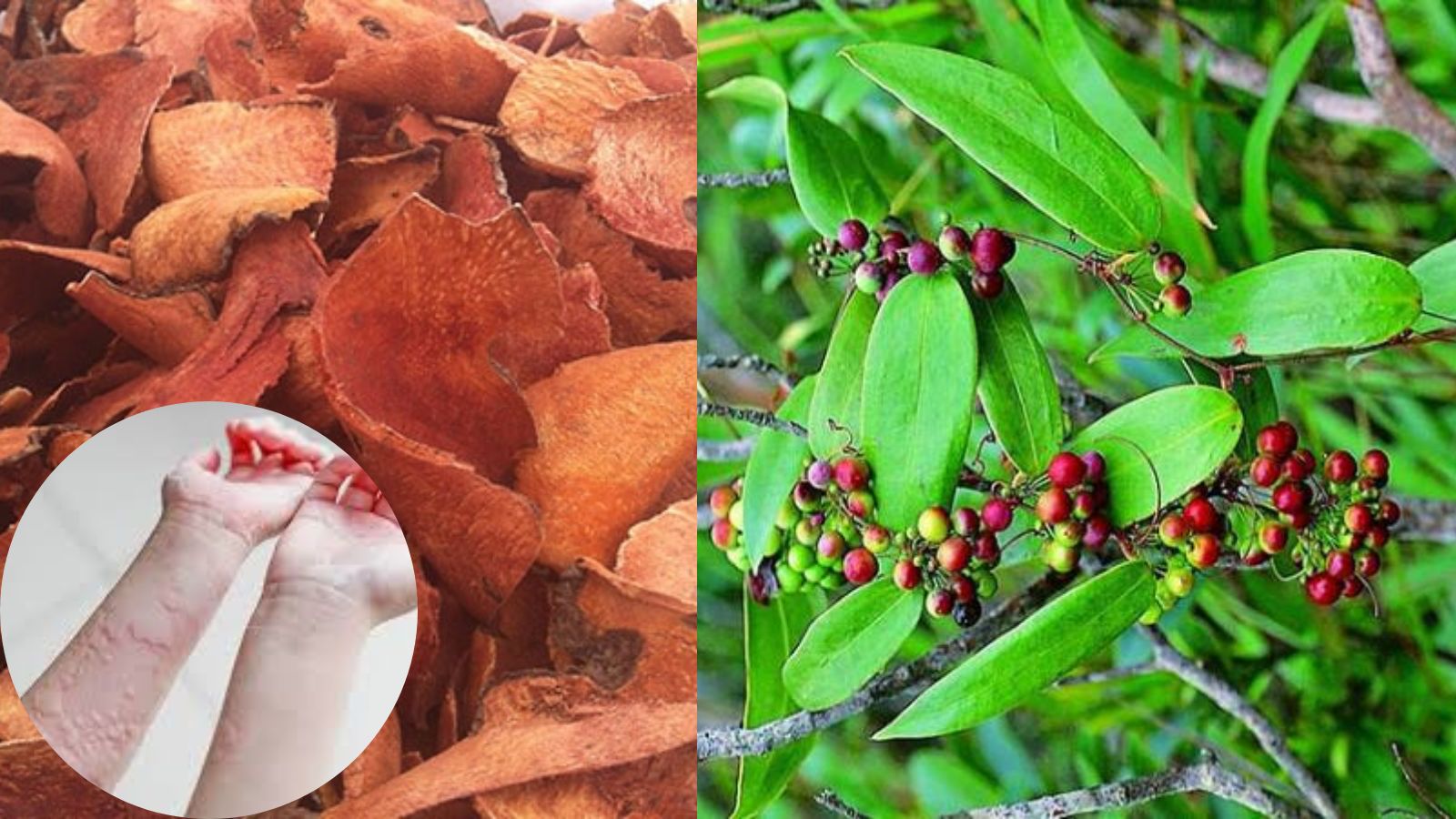 Thổ phục linh hỗ trợ Bắn Cá HZ88 là trò chơi giải trí điện tử mẩn ngứa, dị ứng