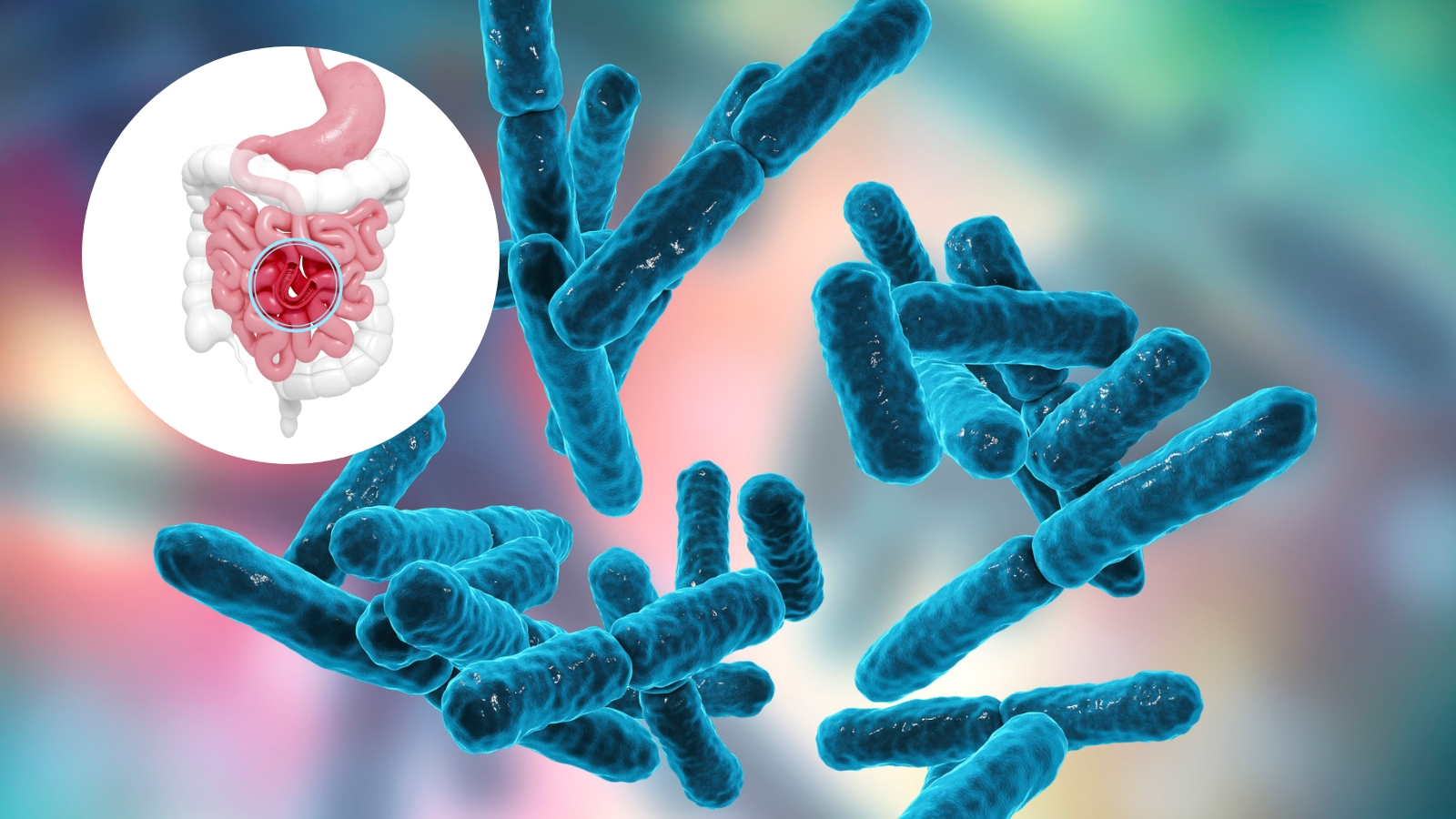 Lactobacillus l&agrave; một trong hai chủng vi khuẩn c&oacute; lợi cho đường ti&ecirc;u ho&aacute;