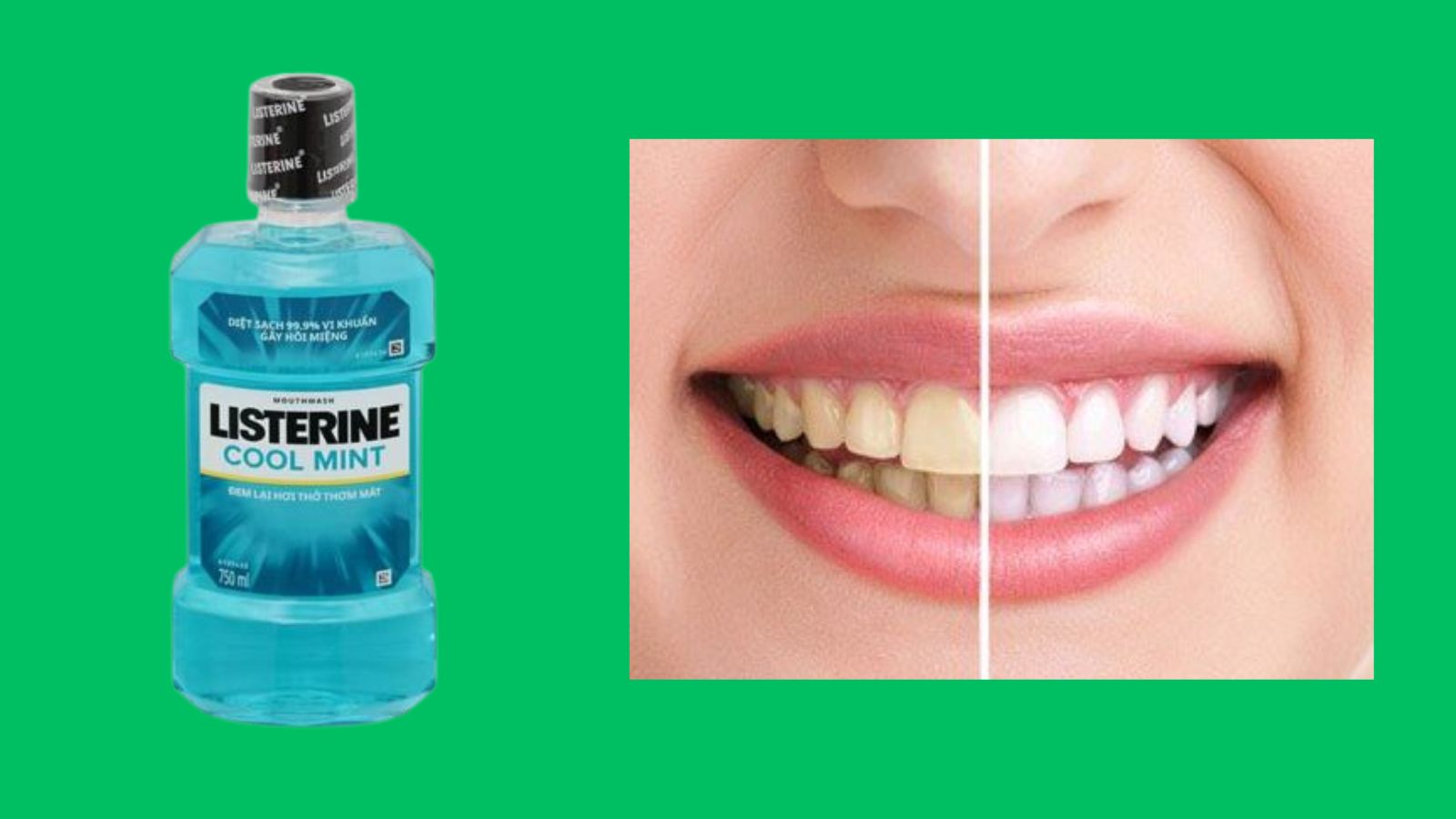 Listerine cool mint 750ml - Nước s&uacute;c miệng h&agrave;ng ng&agrave;y