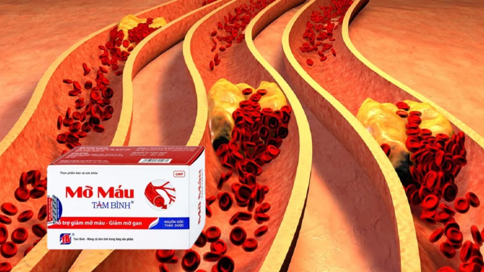 Mỡ m&aacute;u T&acirc;m B&igrave;nh-Hỗ Trợ Giảm Mỡ M&aacute;u, Giảm Cholesterol