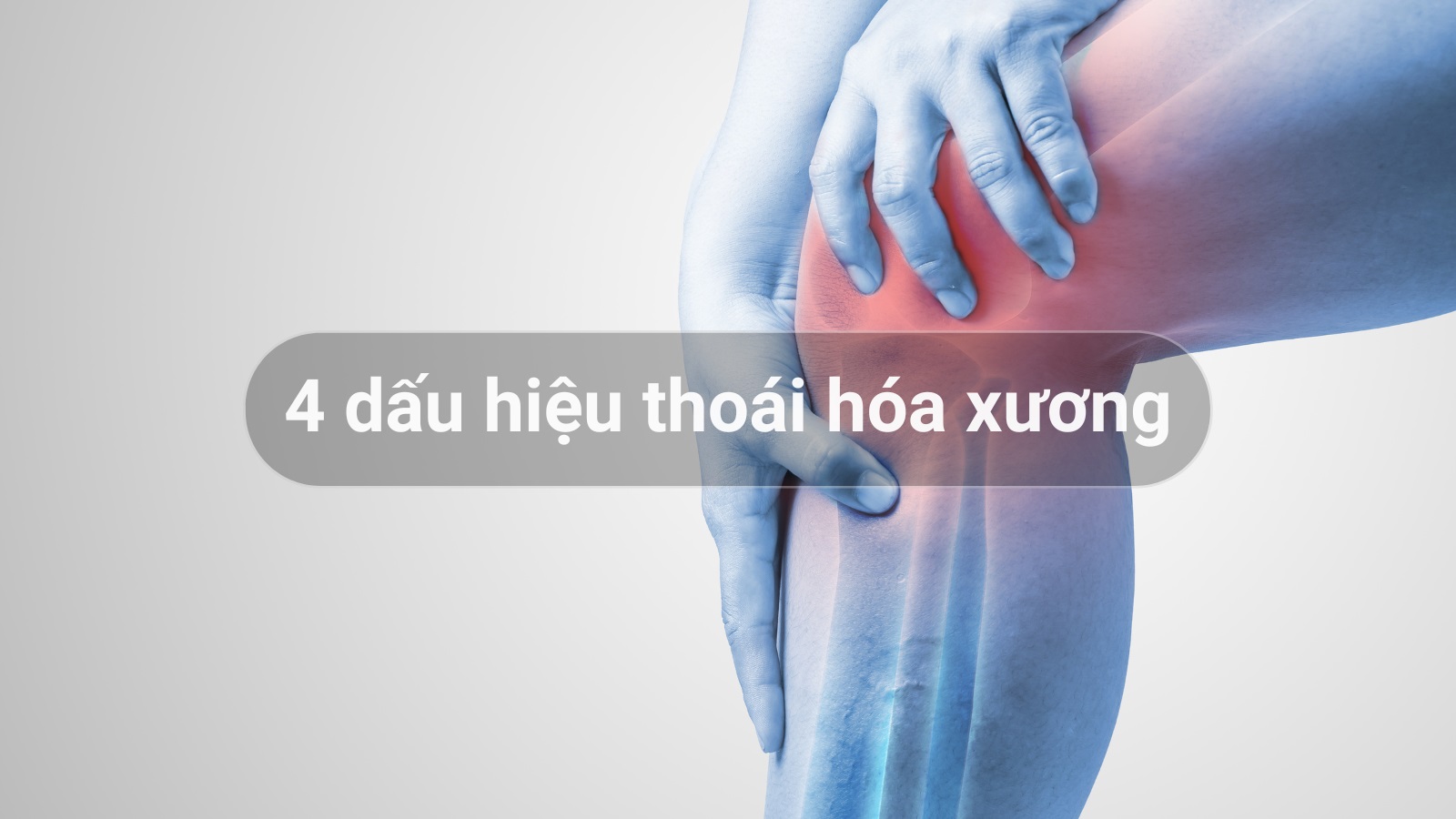 4 dấu hiệu tho&aacute;i h&oacute;a sụn khớp