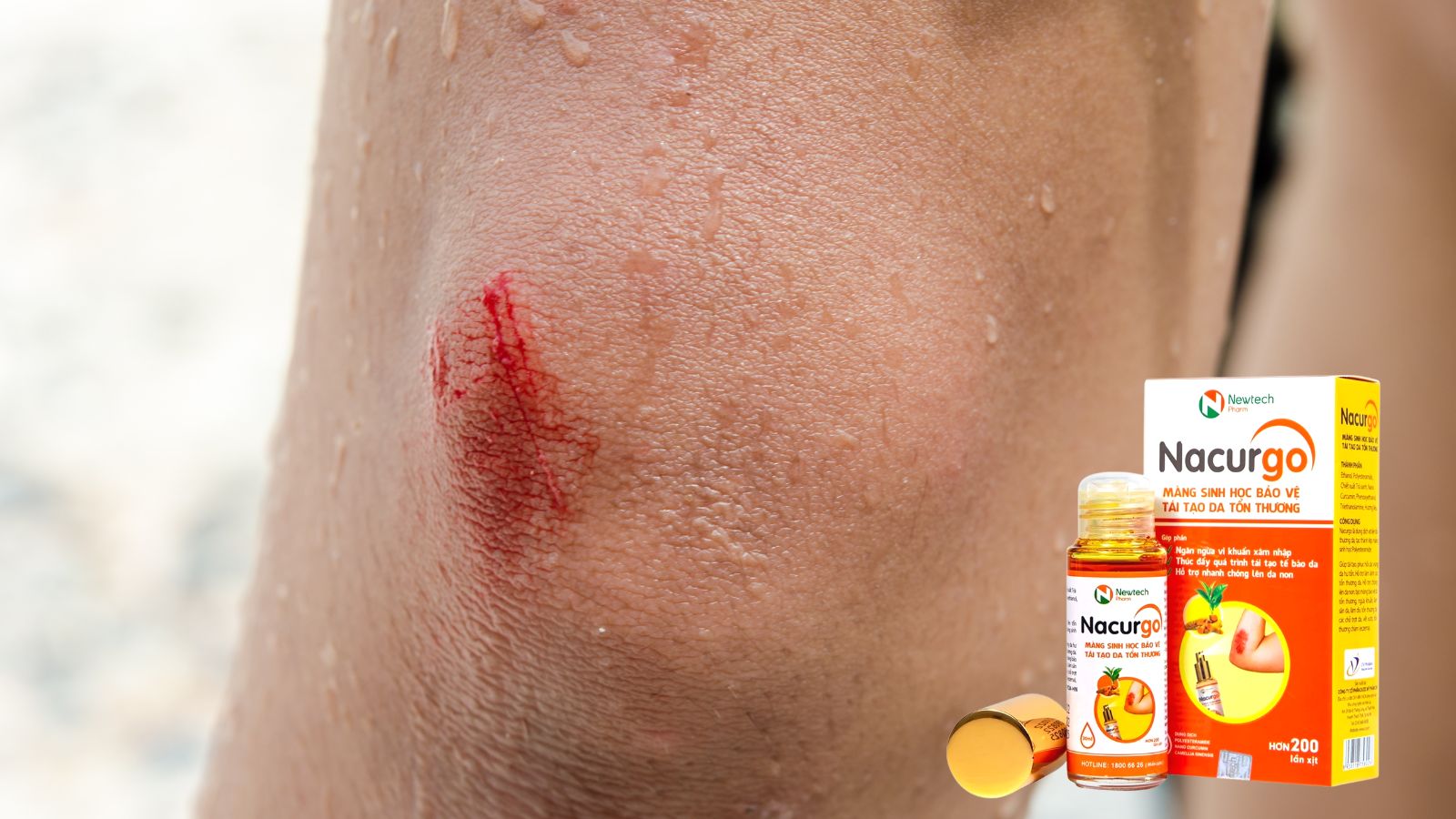 Nacurgo 12ml - Xịt tạo m&agrave;ng bảo vệ vết thương