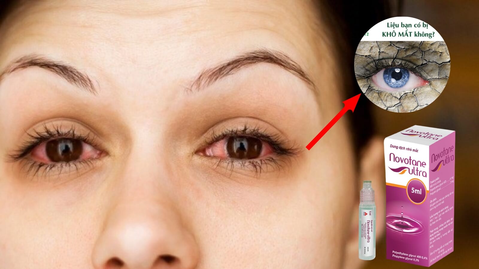 Dung dịch nhỏ mắt Novotane Ultra gi&uacute;p tạo độ ẩm cho mắt.