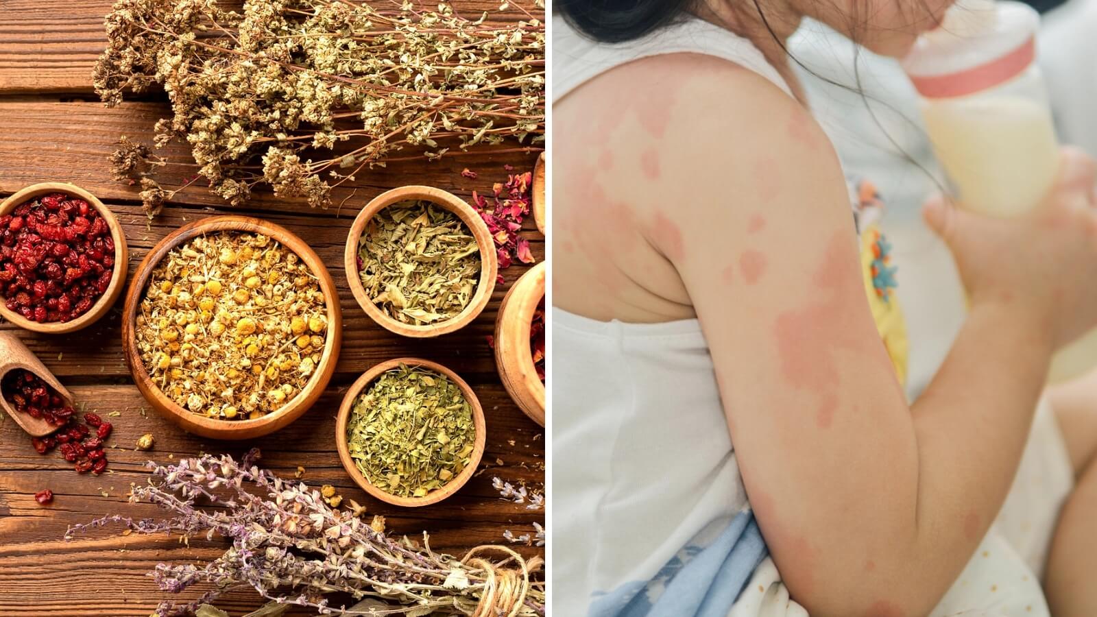C&aacute;c loại thảo dược trong Nước tắm thảo dược Dr Papie hỗ trợ Bắn Cá HZ88 là trò chơi giải trí điện tử ngứa ng&aacute;y, vi&ecirc;m da ở trẻ em