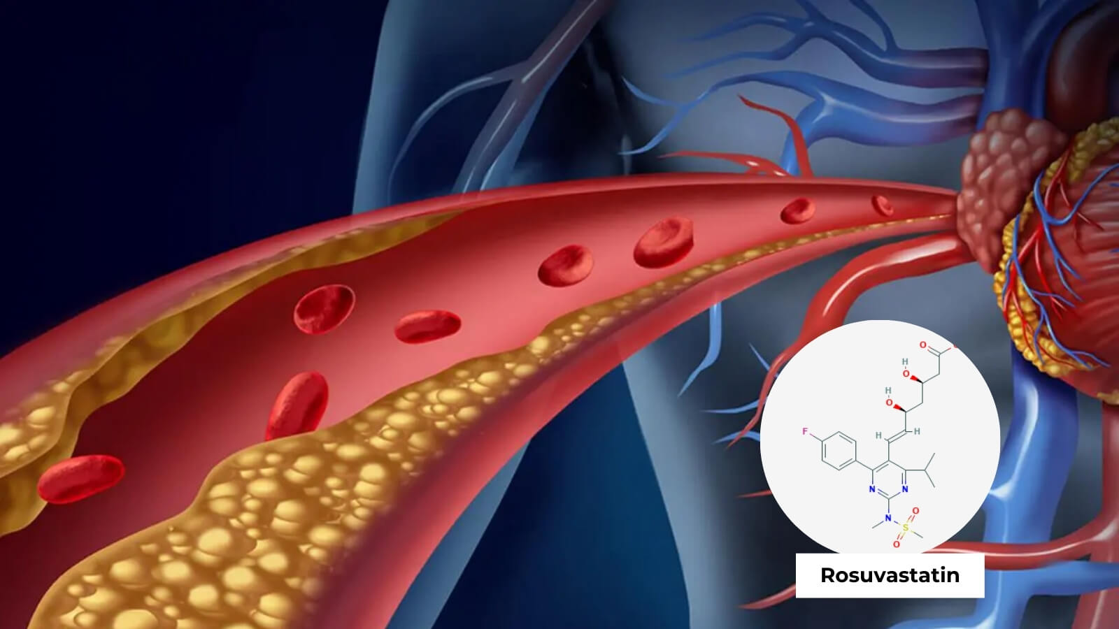 Rosuvastatin trong thuốc được sử dụng để giảm lượng cholesterol xấu trong m&aacute;u