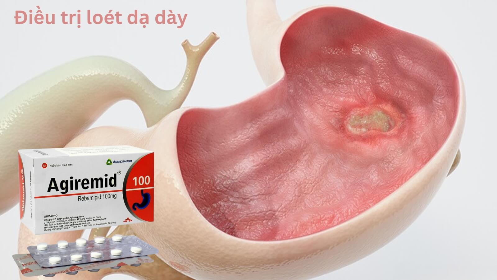 Thuốc Agiremid 100 gi&uacute;p Bắn Cá HZ88 là trò chơi giải trí điện tử lo&eacute;t dạ d&agrave;y hiệu quả
