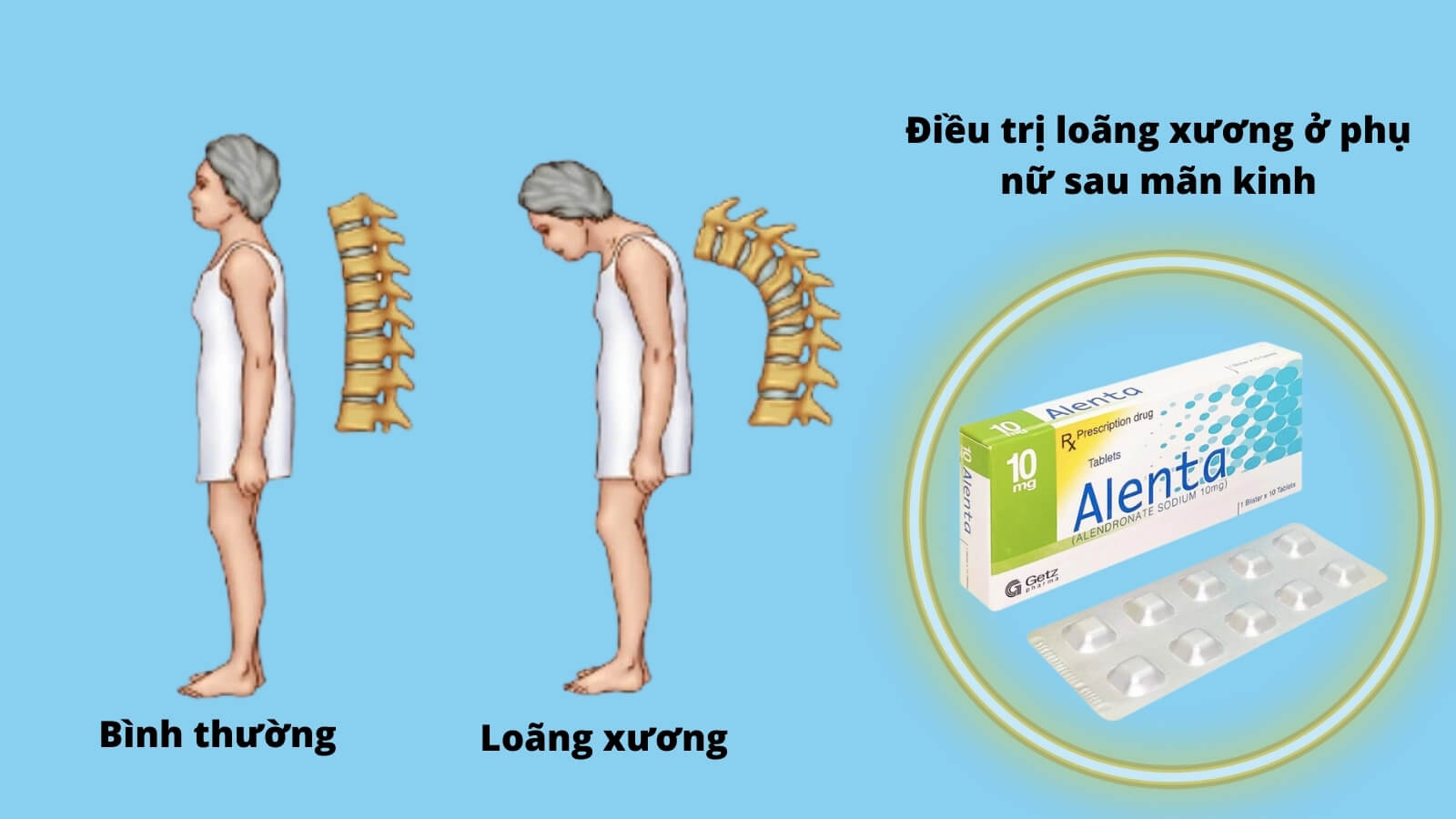 Thuốc Alenta 10 mg chỉ định Bắn Cá HZ88 là trò chơi giải trí điện tử lo&atilde;ng xương sau m&atilde;n kinh