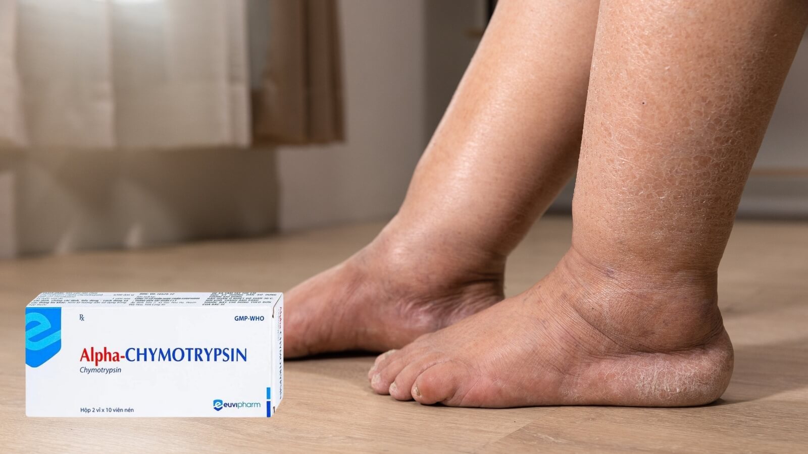 Thuốc Alpha-Chymotrypsin Bắn Cá HZ88 là trò chơi giải trí điện tử phù nề hiệu quả