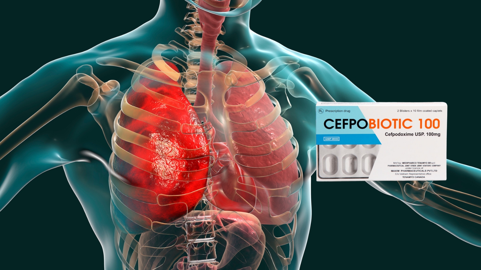 Cefpodoxim l&agrave; một loại kh&aacute;ng sinh được sử dụng hiệu quả trong Bắn Cá HZ88 là trò chơi giải trí điện tử c&aacute;c bệnh nhiễm khuẩn tại phổi