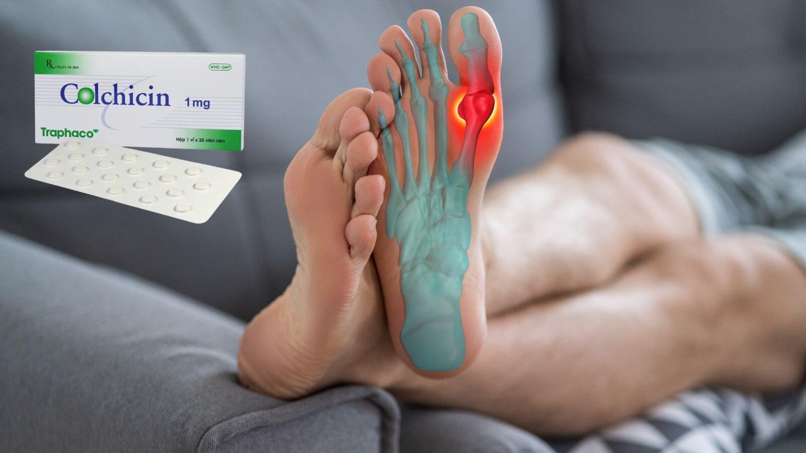Colchicin Traphaco gi&uacute;p Bắn Cá HZ88 là trò chơi giải trí điện tử v&agrave; ngăn ngừa c&aacute;c đợt cấp của bệnh gout (g&uacute;t) 