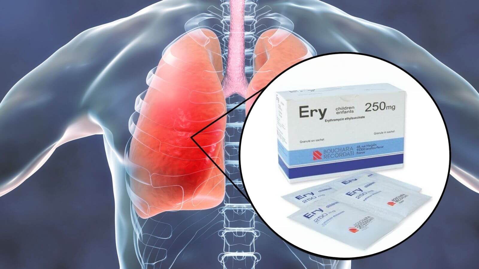Ery 250 k&igrave;m h&atilde;m sự ph&aacute;t triển của Trang chủ đăng nhập HZ88 không chặn tặng 88K g&acirc;y vi&ecirc;m phổi